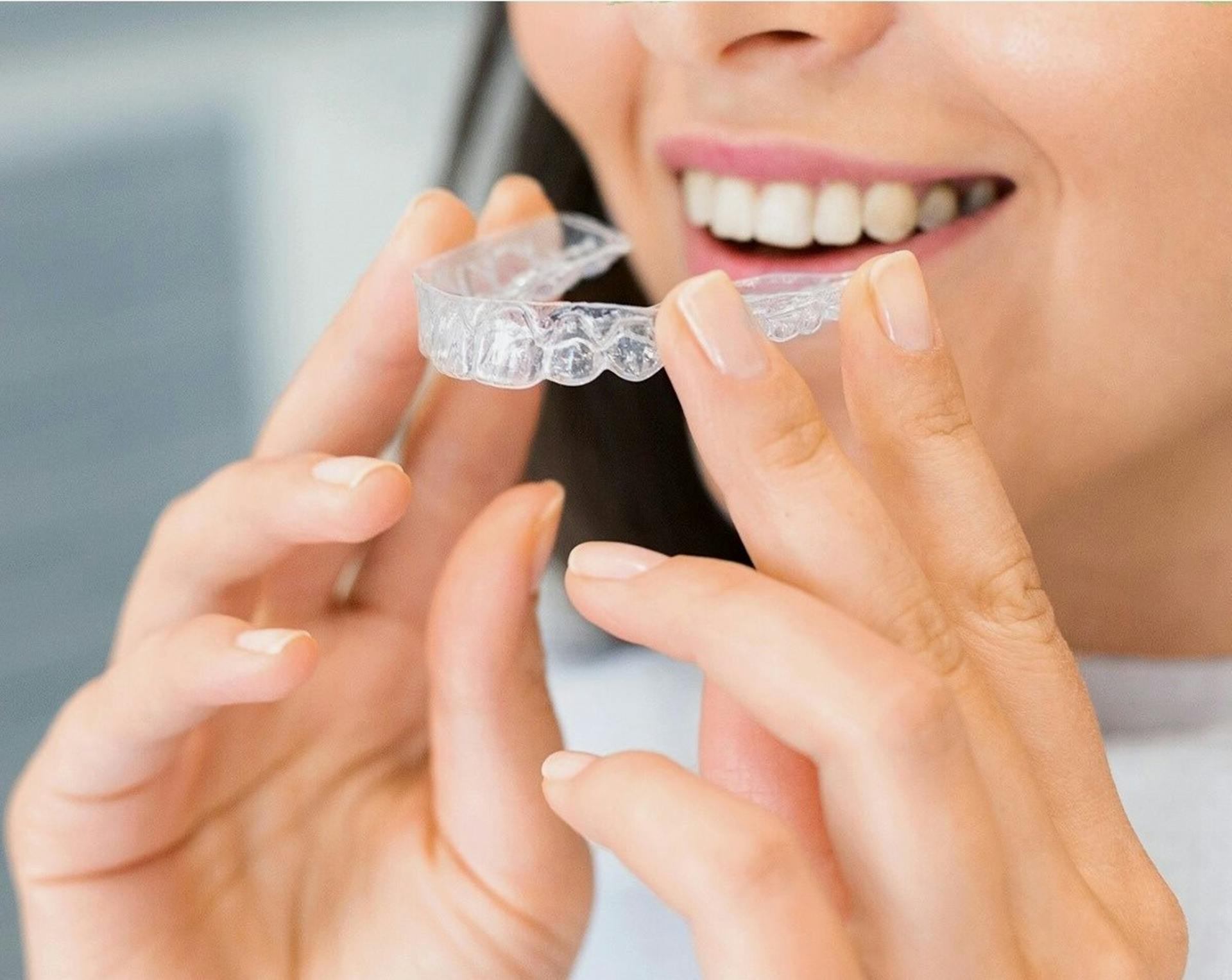 lifetime retainer