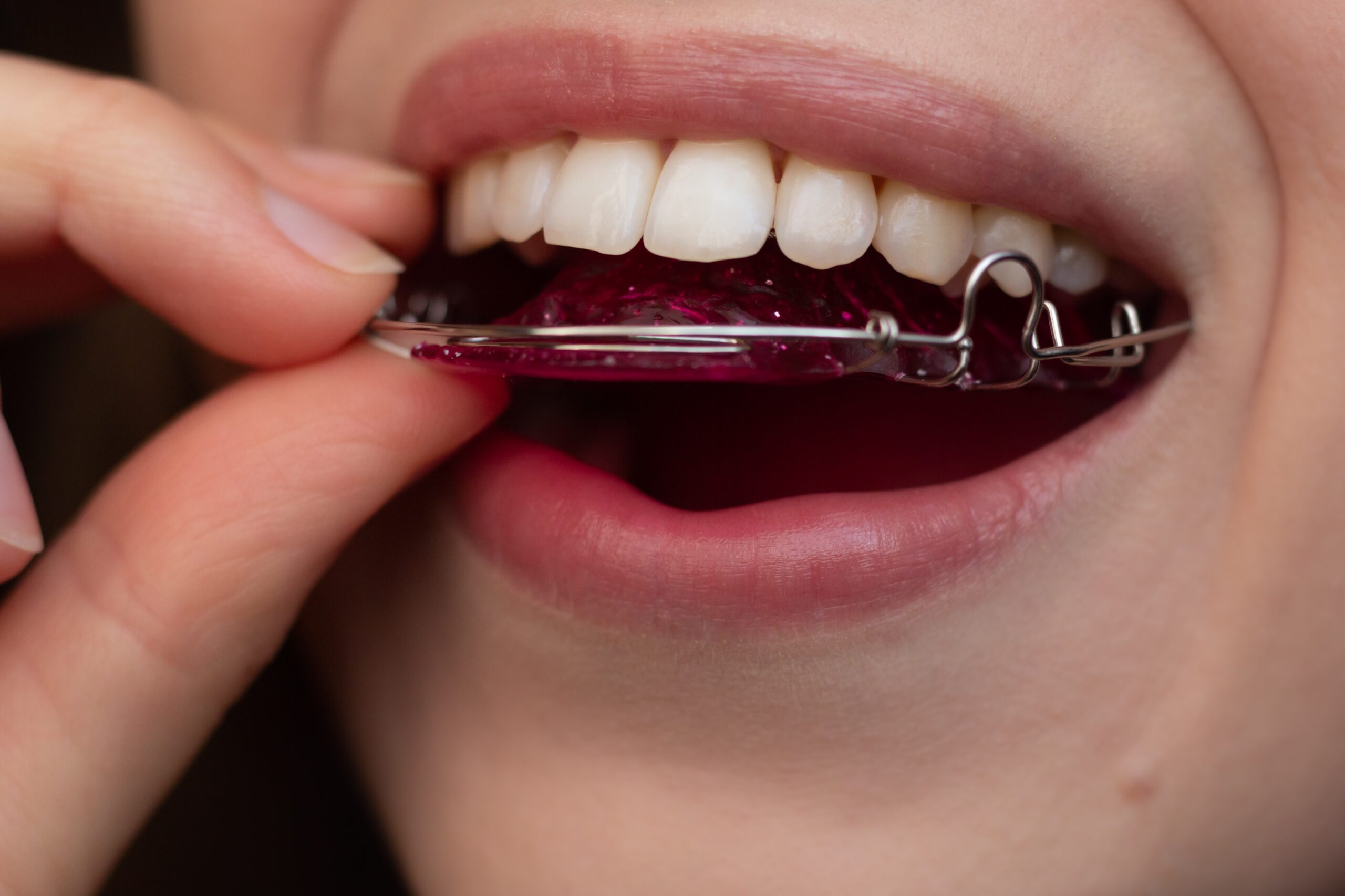 retainer