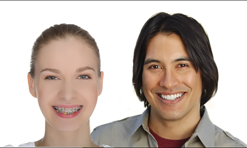 How to Choose–Braces vs Invisalign
